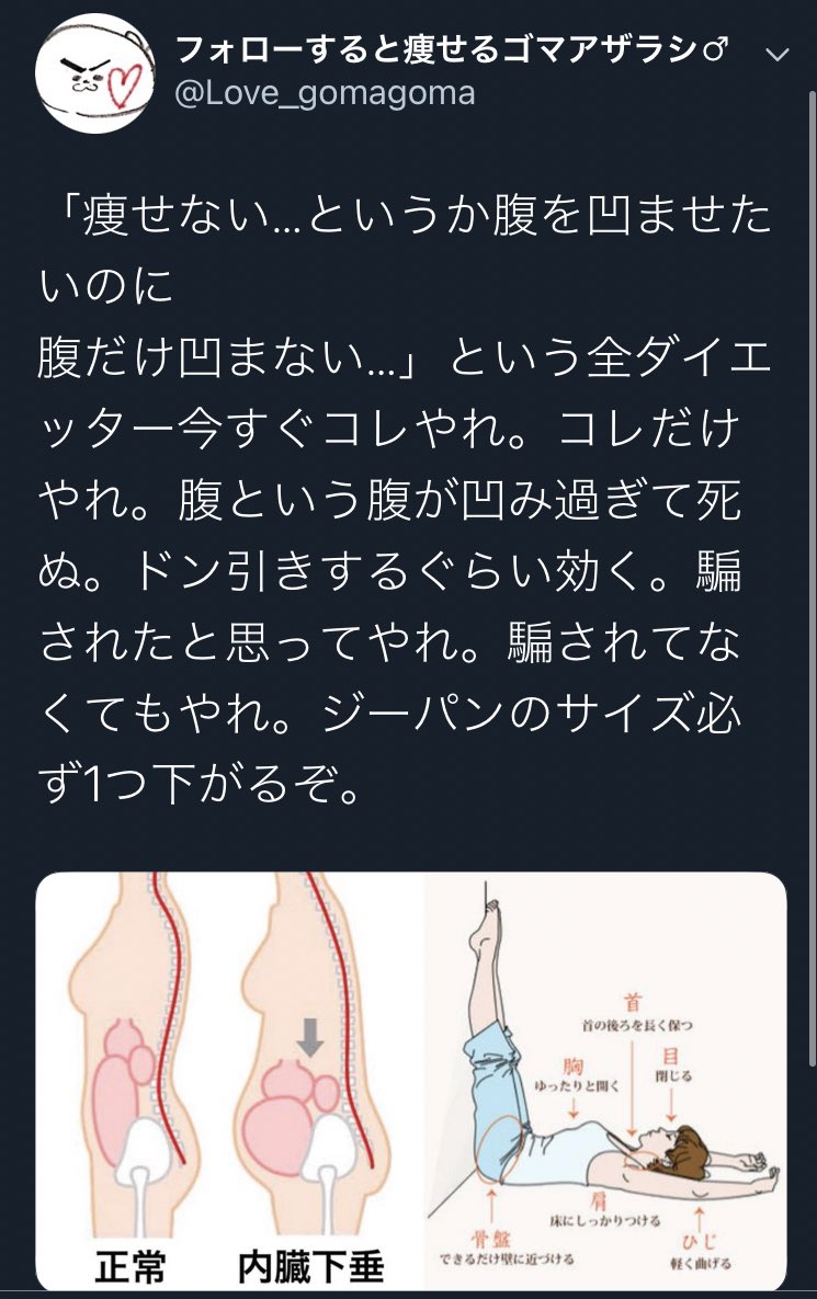 ほねつぎのヒト 絵依頼受付垢 これ患者によく言うんだけど 貧困民の子供の体型思い出してみ ガリガリなのに腹出てんだろ 栄養ないと体は生きてくためにタンパク質 例えば筋肉 をエネルギー変換してんだよ てことは筋肉つけた方が腹凹むのは必然的な話
