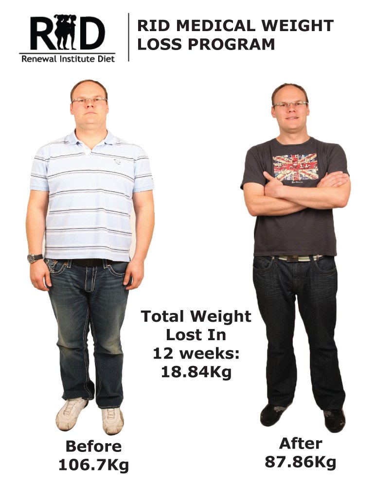 DrEddyClinic's tweet photo. RT @SkinBodyRenewal: At the Renewal Institute we have years of experience in helping people to achieve weight loss goals. Here is why our programme stands apart from all others https://t.co/kSgq95jcBB
#RID #RenewalInstituteDiet #medicalweightlossprogram… https://t.co/hygUhPNJZt