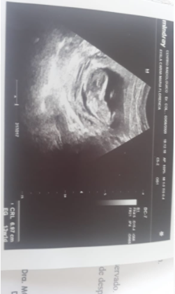 Aqui Flor con #SeguroDeAntojos que espera helado de Grido para el Baby  <a href="/GridoHelados/">Grido Helado</a> 😍