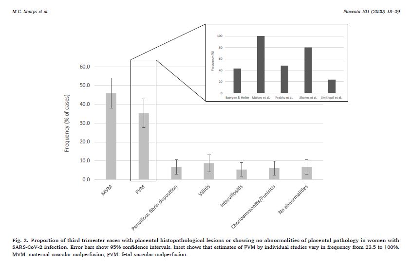 tl/dr: Great review of placental findings in COVID-19!
pubmed.ncbi.nlm.nih.gov/32911234/

discovered with <a href="/orbitcme/">Orbit CME</a> for <a href="/pathologycast/">pathCast</a>. Earn SAM for this article at orbitcme.com/join/pathcast

#pathcast #pathology #gynpath #obgynpath #obpath #perinatalpath #placentapath