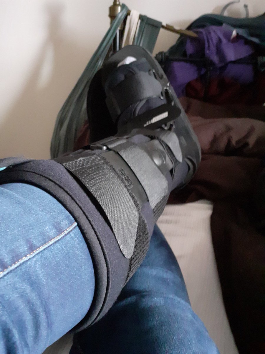 shellmsk_'s tweet photo. Hi guys xxxx sorry ive not been here, just mainly posting on fb. 
Currently at home for next 4 weeks with a fractured ankle after a seriously twisted ankle accident. Yes i was sober!! If anyone wants to contact me directly Im on fb and whats app. Just pm me. Hope you are all ok https://t.co/MS7pLrcRvz