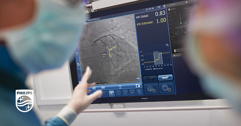 PhilipsPR's tweet photo. #DEFINEPCI study 1-yr data demonstrate the potential of treating residual ischemia to improve clinical outcomes for coronary stent patients. Read the news: https://t.co/rKj4W8Rmif https://t.co/rD96GbJH1n
