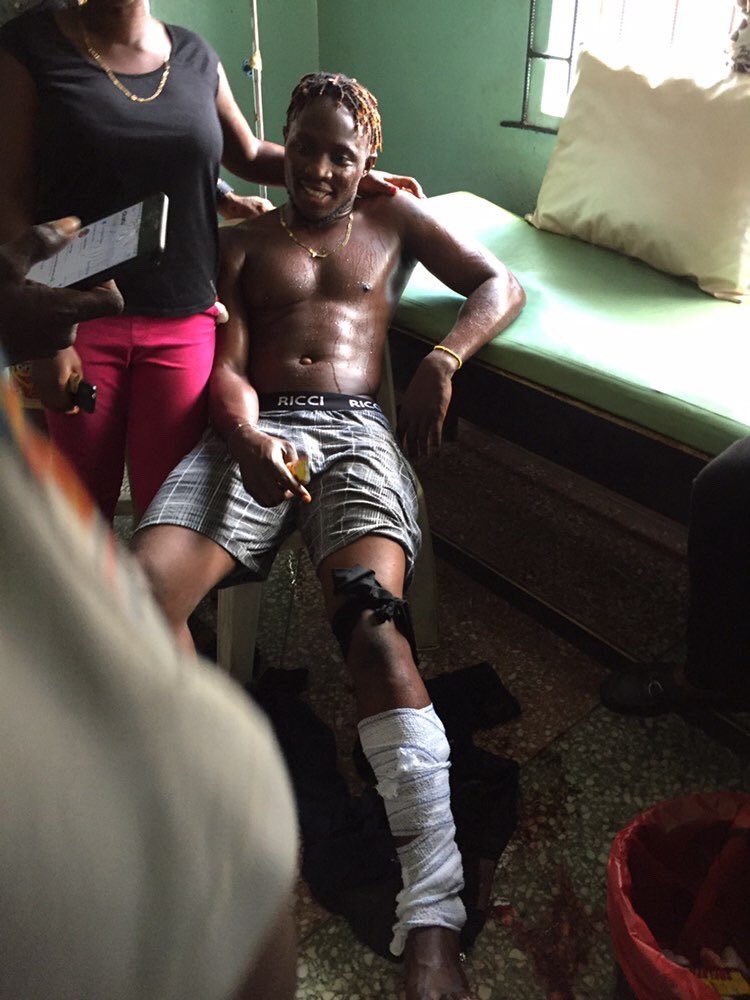 StatesOfMemes's tweet photo. This guy was reportedly shot at the disrupted #AlausaProtest this morning. He needs help and more recognition. Please Retweet!!!
#EndsSARS #EndPoliceBrutalityNigeria 
James Nwafor | MC Oluomo | Starboy | Wizkid https://t.co/G2CL08GJo7