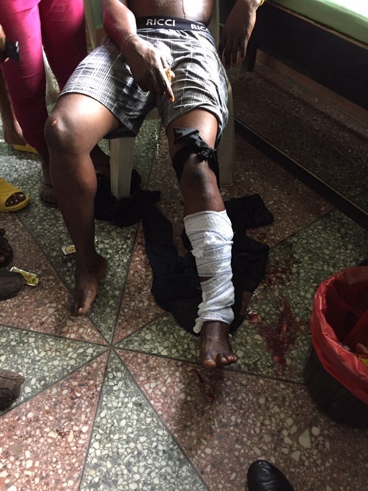 StatesOfMemes's tweet photo. This guy was reportedly shot at the disrupted #AlausaProtest this morning. He needs help and more recognition. Please Retweet!!!
#EndsSARS #EndPoliceBrutalityNigeria 
James Nwafor | MC Oluomo | Starboy | Wizkid https://t.co/G2CL08GJo7
