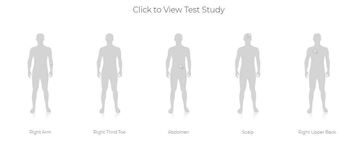 myPathMelanoma's tweet photo. Want to see examples of myPath® Melanoma in action? We have several relevant case studies showcasing benign and malignant test results.  https://t.co/7I47cVikdb #CaseStudy #MelanomaTesting #Melanoma #SkinCancer #myPathMelanoma https://t.co/gOrBuyIvpE