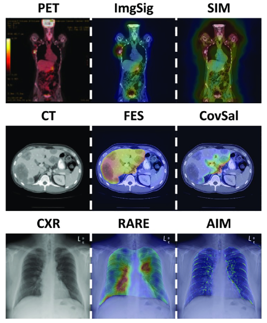 ARVOJOV's tweet photo. Just published in @ARVOJOV, a review on attempts to characterize and predict #gaze behavior in radiologists.
Read more here: https://t.co/bnYpuIqP3w @sunydownstate #radiology #visionscience #visualcognition #perceptuallearning #OpenAccess https://t.co/jhCHEaHP35