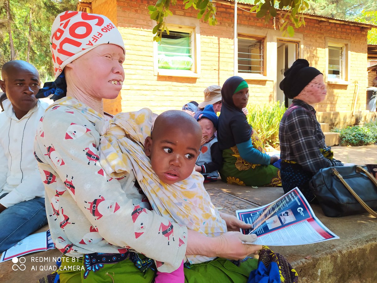 bonmassah's tweet photo. Our furthest skin cancer prevention clinic, we just arrived at Ngapani, Sable farming Estate, Malawi Mozambique border Taking the service to where it's most needed #AmplifyingVoice #NoSkinCancer @StandingVoice https://t.co/QG8GEqNguY
