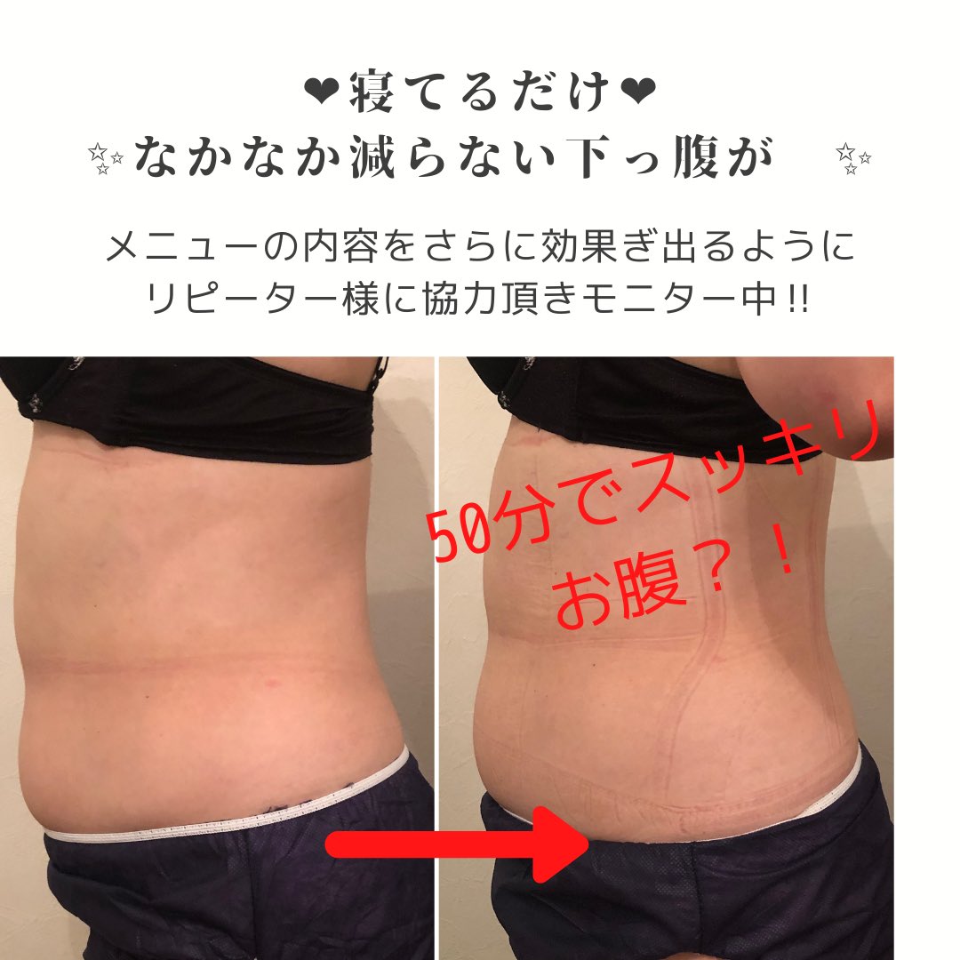 お腹の脂肪 お腹の脂肪
