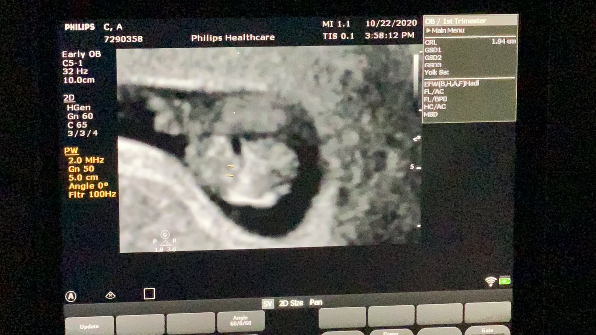 turtle797's tweet image. My soon to be mini me ❤️ may 2021 can’t come sooner 🥺🥰