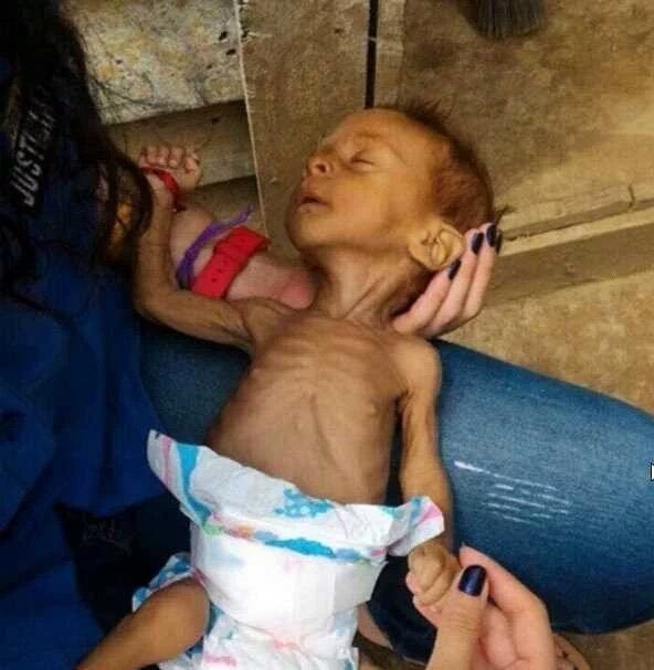 abgyana's tweet photo. INTERVENCIÓN MILITAR EXTRANJERA por nuestros NIÑOS! A la alimentación, educación, respeto, óptima calidad de vida y más!! "Por sobre los derechos de los niños, SUCUMBEN los demás derechos!
@realDonaldTrump
@JOHSIEC
#TASK4FORCE
#VenezuelaWaitingTrump https://t.co/BJPel3NTMZ