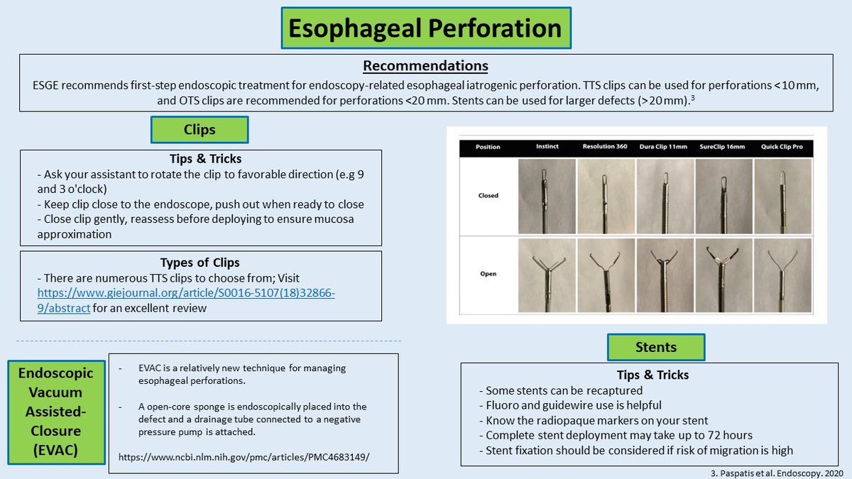 #ScopingSundays (@scopingsundays) on Twitter photo Missed out on the 🔥🔥 #ScopingSundays discussion this weekend on “Understanding Endoscopic Tools in EGD” ?
Check out the #ScopingSummary from the interactive discussion led by <a href="/AllonKahn/">Allon Kahn, MD</a>, <a href="/NickMcDonaldMD/">Nick McDonald</a> & <a href="/AhmadBazarbashi/">Ahmad Bazarbashi أحمد بازارباشي</a> !
Special thanks to <a href="/nate_alhalel/">Nate Alhalel</a> for the summary ! Missed out on the 🔥🔥 #ScopingSundays discussion this weekend on “Understanding Endoscopic Tools in EGD” ?
Check out the #ScopingSummary from the interactive discussion led by <a href="/AllonKahn/">Allon Kahn, MD</a>, <a href="/NickMcDonaldMD/">Nick McDonald</a> & <a href="/AhmadBazarbashi/">Ahmad Bazarbashi أحمد بازارباشي</a> !
Special thanks to <a href="/nate_alhalel/">Nate Alhalel</a> for the summary !