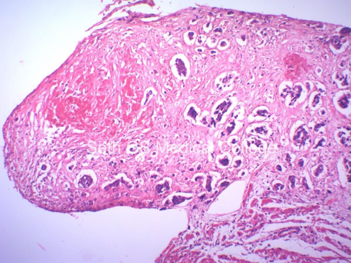 Pranita Zare tweet media