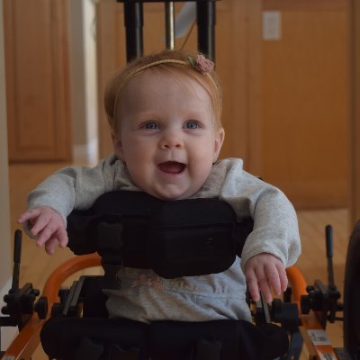 shop124street's tweet photo. Have you met @HankiHarper?
She's suffering from a very rare, life-threatening illness that will claim her life if she doesn’t receive treatment within the year.  https://t.co/i2kCe8UYxV https://t.co/FFY7wL4wDv