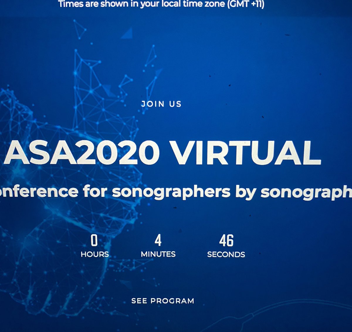 5 minutes to go to the Australasian Sonographer Association Virtual Conference. I’m soooo looking forward to this weekend event! <a href="/asasonography/">ASA</a> #ASA2020VIRTUAL <a href="/Samanth53610315/">Samantha Thomas</a>