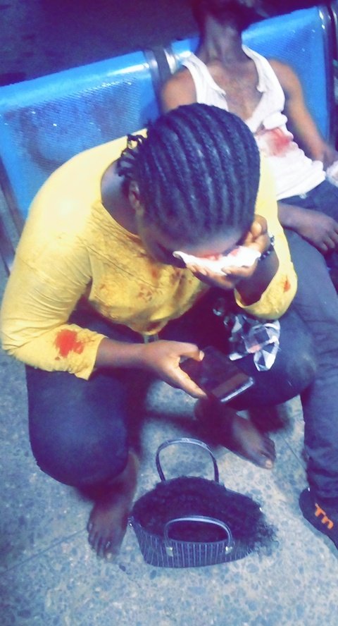 Kikky1001062287's tweet photo. Updates!!! Protesters were attacked by some thugs at Alausa. The Injured protesters are currently at Lagos State Teaching Hospital. #EndSARS #EndSWATNOW #EndPoliceBrutality https://t.co/O2H383S3Fd