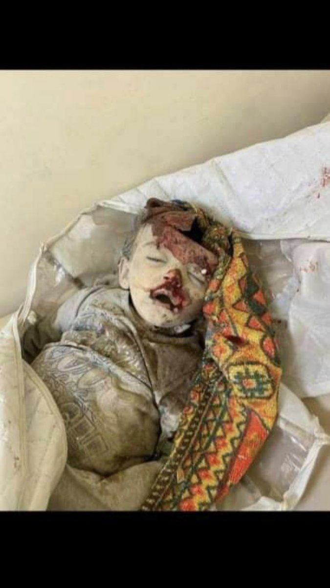 arazaliyeff's tweet photo. Why is this world silent?
Son of bitchs armenian people
#prayforGandja
#stoparmenianterror 
#stopfakenewsarmenia 
#stoparmenianaggression 
#stopattackingcivilians 

@OzelKuvvetlerTC https://t.co/M9RvNB2kUx