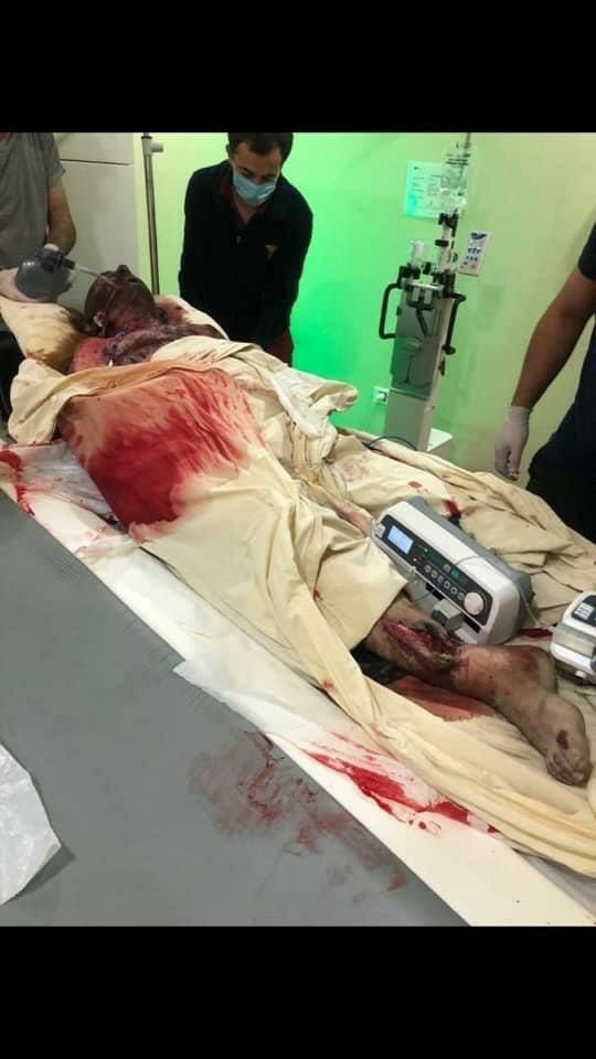 Lachdochdech's tweet photo. Terroristttt what was their fault???? they are just civil people of #Ganja        #StopArmenianTerrorism  #StopArmenianTerror   #StopArmenianAggression https://t.co/vVSJ2FZl2n