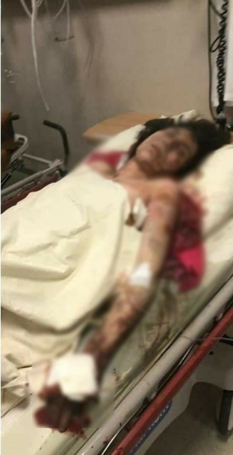 bpthaber's tweet photo. Injured and dead children in Ganja hospital :
#ArmeniaKillsCivilians https://t.co/SPxU3xOguN