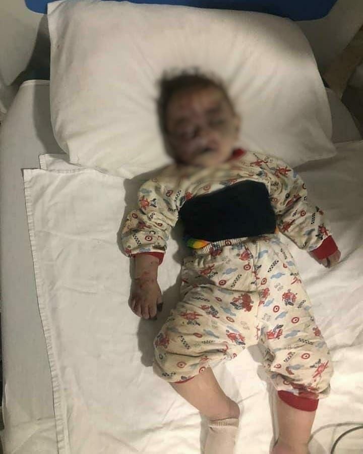 Mesimov2's tweet photo. Armenian Government shelled Azerbaijan's second largest city Gence again! 13 people died. Two of the dead are children. 50 people were injured.This terror .Watch the results in Live stream! Here is the link: 
#PrayForGanja 
#ArmenianTerrorism 
#ArmeniaAgainstTerrorism https://t.co/NIpagFZyKI