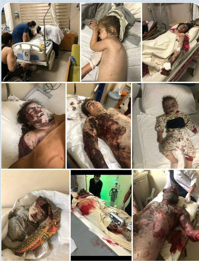 Bazaur's tweet photo. Armenia kills children!
Terrorist Armenian forces intensively started bombing civilians and cities.  This is terrorism!

#armeniaKillsCivilians
#armeniakillschildren
#StopArmenianTerrorism 
#PrayforGanja
#PrayForGandja 
#PrayForGanjaCity 

@CNN @euronews @BBCWorld @UNHumanRights https://t.co/ekcIrsCq2C