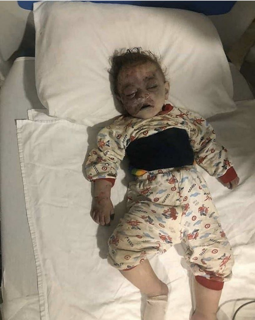 aliyajalill's tweet photo. Dünya bu terrora niyə susur? 
Why is the world silent to this terror? 
Armenia kills civilians, Armenia kills children. 
Do not close your eyes, World! 
#PrayForGanja 
#ArmeniaKillsCivilians
#DontBelieveArmenia https://t.co/1lHLg16tw1