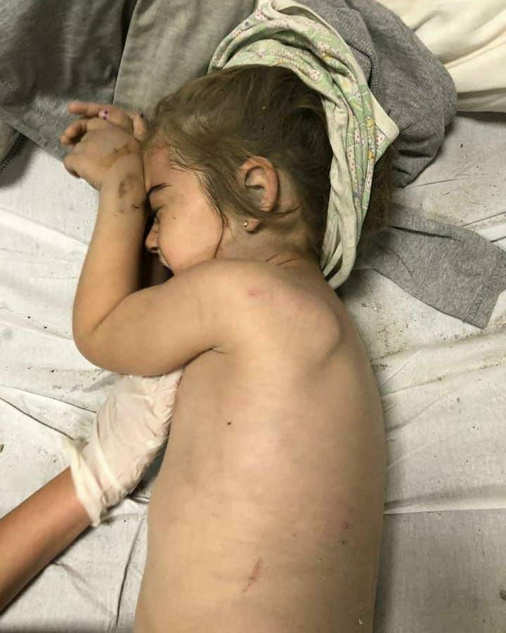 Armenians kill civilians in Ganja...
#openyoureyesworld  #StopArmenianTerrorism #StopArmenianTerror