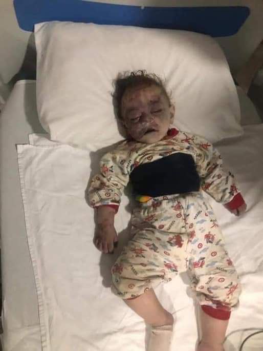 MammadovMukhtar's tweet photo. Next time anybody wants to donate to @ArmeniaFund @ArmFundGlobal, looks at this pics &amp; don't fund #terrrorism. Don't finance #ArmenianTerror! Don't finance the #Nazi sympathizers! Don't finance the #child killers! #PrayForGanjaCity #StopArmenianTerrorism #ArmeniaKillsChildren https://t.co/kzmwerzgoS