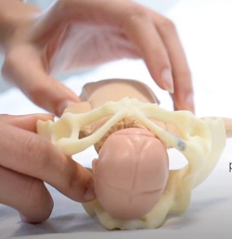 Internal rotation - disebab bentuk special pada otot lantai pelvis tu (V-shaped) kepala baby bila berlaga dgn otot tersebut terpaksa berpusing. Muka baby skang menghadap ke belakang ( Occipitotransverse to OccipitoAnterior )