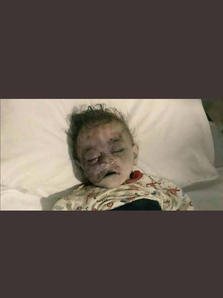 Yine sivillere saldırmaktan,soykırım yapmakdan başka bildiğiniz birşey yok.Okadar delikanlı iseniz azerbaycan askerlerinin karşısına çıkında görelim.Lanet olsun size korkak ermenistan.... #ArmenianAggression