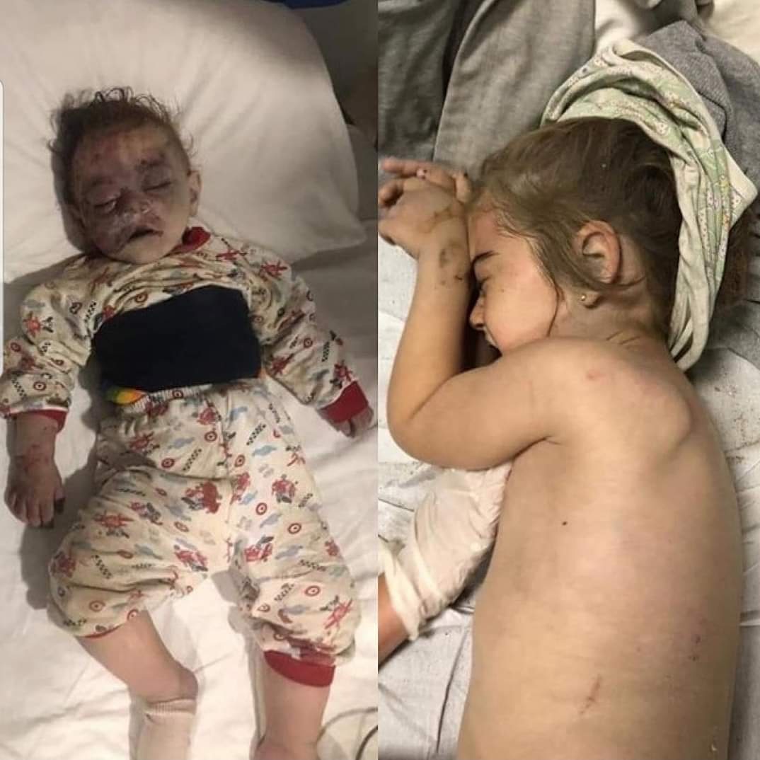 Another armenian attack on civilians far from the war zone. Azerbaijan's second biggest city bombed by armenians at night, 13 people died and more than 40 people wounded, still many under the debris.
Kids, elder people sleeping peacefully at night!
#stoparmenianterror