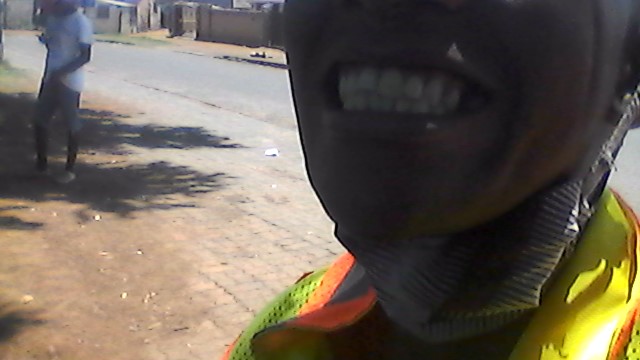 ThembaRajuili's tweet image. my new cracked smile and scar on the chin....#Tagthisnote #Symmetry...Somethings are to disgusting to discuss here