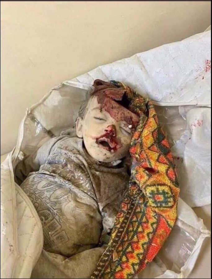 Şu fotoğraf bir Ermeni çocuğa ait olsaydı muhtemelen bugün dünyayı ayağa kaldırmıştınız. Anladık ırkçısınız, hastalıklı fanatik bir düşünce yapınız var ama insan olan şu fotoğrafa bakar utanır. Tabi insan ise #ŞerefsizGaroPaylan