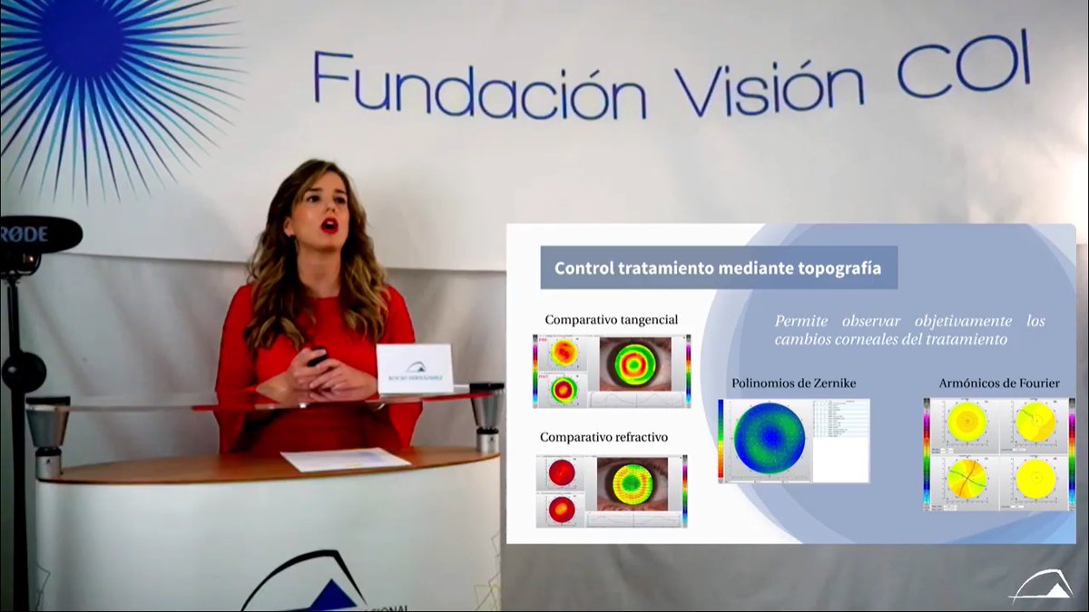 COI_Optometria's tweet photo. Seguimos con el TFM “Estudio de la película lagrimal y las glándulas de Meibomio a corto plazo tras el uso de #orto-K” realizado por Daniel Sirvent, Ignacio M. Jiménez, Rocio Fernández y Manuel Freire. Tutor: Antonio Verdejo 

#JornadasCOI #MasterCOI #PeliculaLagrimal https://t.co/nr1McPC9Jg