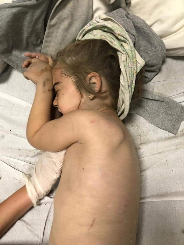 diese Welt ist weder blind noch taub.Es ist so ungereght, dass unschuldige Kinder den Tod nicht sehen möchten 
#PrayForGanja #PrayForGandja #PrayForGandjaCity #StopArmenianAggression #StopArmenianTerrorism #StopAttackingCivilians #OpenYourEyes