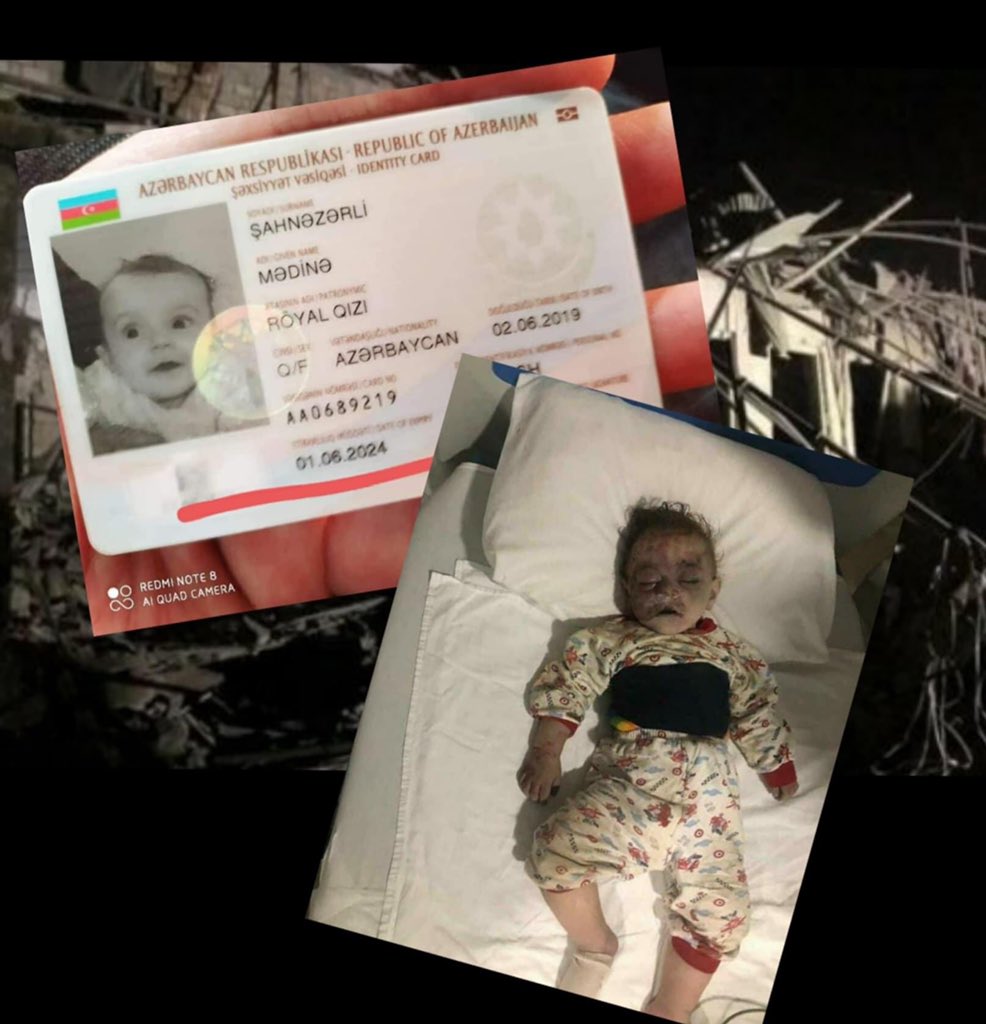 A 16-month-old victim of the Ganja terror that took place tonight. Along with this baby, his father was also killed. #StopArmenianAggression #ArmeniaKillsCivilians #KarabakhisAzerbaijan #StopArmenianOccupation #DontBelieveArmenia #GanjaCity