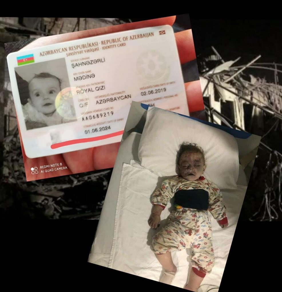 A 16-month-old victim of the Ganja terror that took place tonight.  Along with this baby, his father was also killed. #StopArmenianAggression
#ArmeniaKillsCivilians
#KarabakhisAzerbaijan
#StopArmenianOccupation
#DontBelieveArmenia #GanjaCity