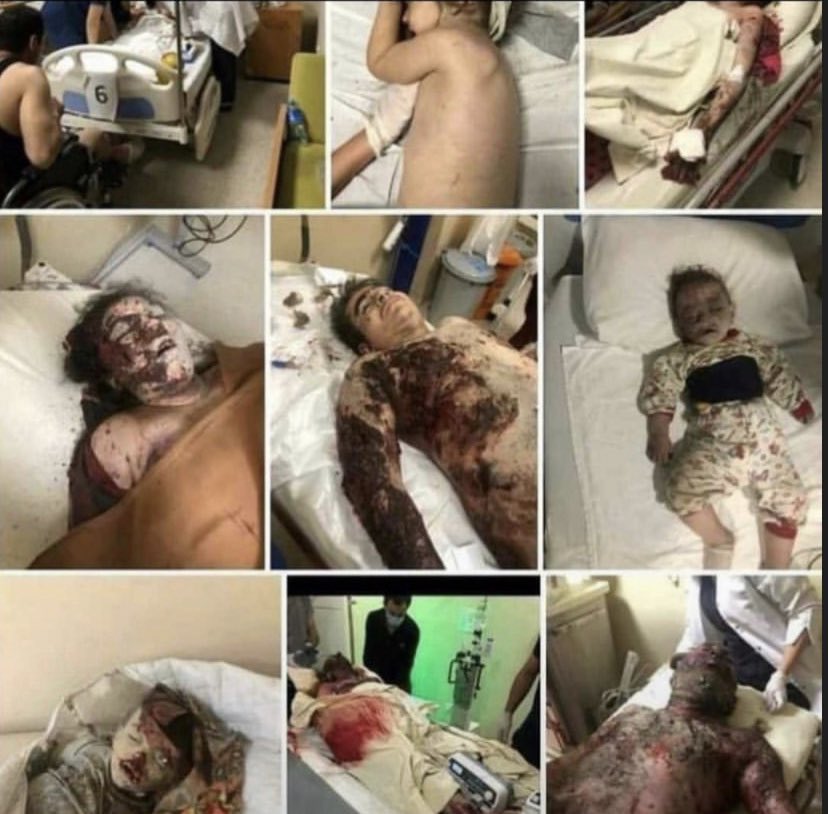 The current member of the CSTO - ODKB Armenia bombed civilians in Azerbaijan
12 Azerbaijani Civilians Killed
We demand:
#EconomicsanctionstoArmenia
#ExcludeArmeniafromODKB
#ExcludeArmeniafromCSTO
#ExcludeArmeniafromregionalprojects 
#ExcludeArmeniafrominternationalprojects