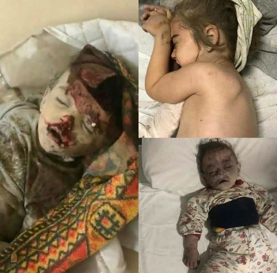 Turan62845257's tweet photo. These innocent children were sleeping away from the territory of war in Ganja when they were exposed to #ArmenianTerrorism 

#armeniansarebabykiller
#stoparmenianagression https://t.co/1u9YBcHpwJ