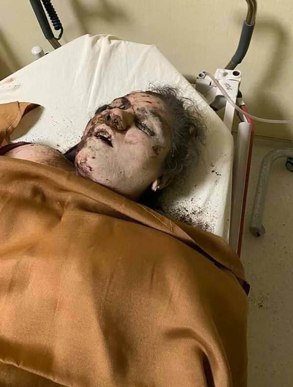 AgXtrav's tweet photo. The terrorist state of Armenia is attacking civilians again and again. This time, several houses and facilities of the children's center were destroyed. 35 civilians wounded and 6 civilians killed as a result  missile attacks on #Ganja.

#StopArmenianTerrorism
#PrayForGanjaCity https://t.co/f8hVUaSne8