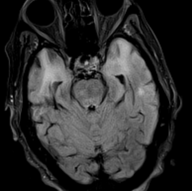 UMaryland Neuroradiology tweet media