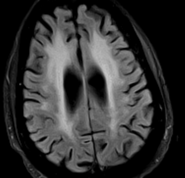UMaryland Neuroradiology tweet media