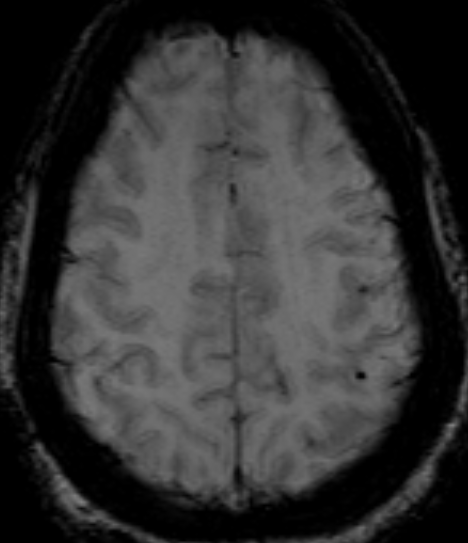 UMaryland Neuroradiology tweet media