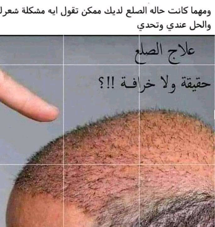 SaerSahar's tweet photo. للتفاصيل اتواصل على الخاص https://t.co/DpDBSNnmKH