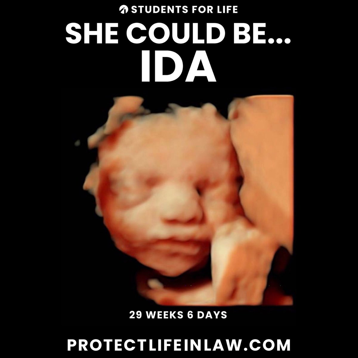 SFLAction's tweet photo. #SheCouldBe anything, but not if she’s aborted.
We deserve a Supreme Court Justice who will #ProtectLifeinLaw and be a #Justice4Life. We must #ConfirmAmy. Give her a vote. Give her a voice.
TAKE ACTION: Urge your Senators to confirm Amy: https://t.co/wXho9qTdGA https://t.co/rjwxTQO6CD