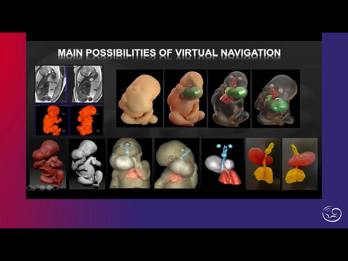 MaternoFetalMX's tweet photo. Amazing images! #VirtualNavigation #ArtificialIntelligence in #Imaging Prof #HeronWerner 
#ISUOG2020 #LoveUltrasound @ISUOG https://t.co/VdJRO1iD5R