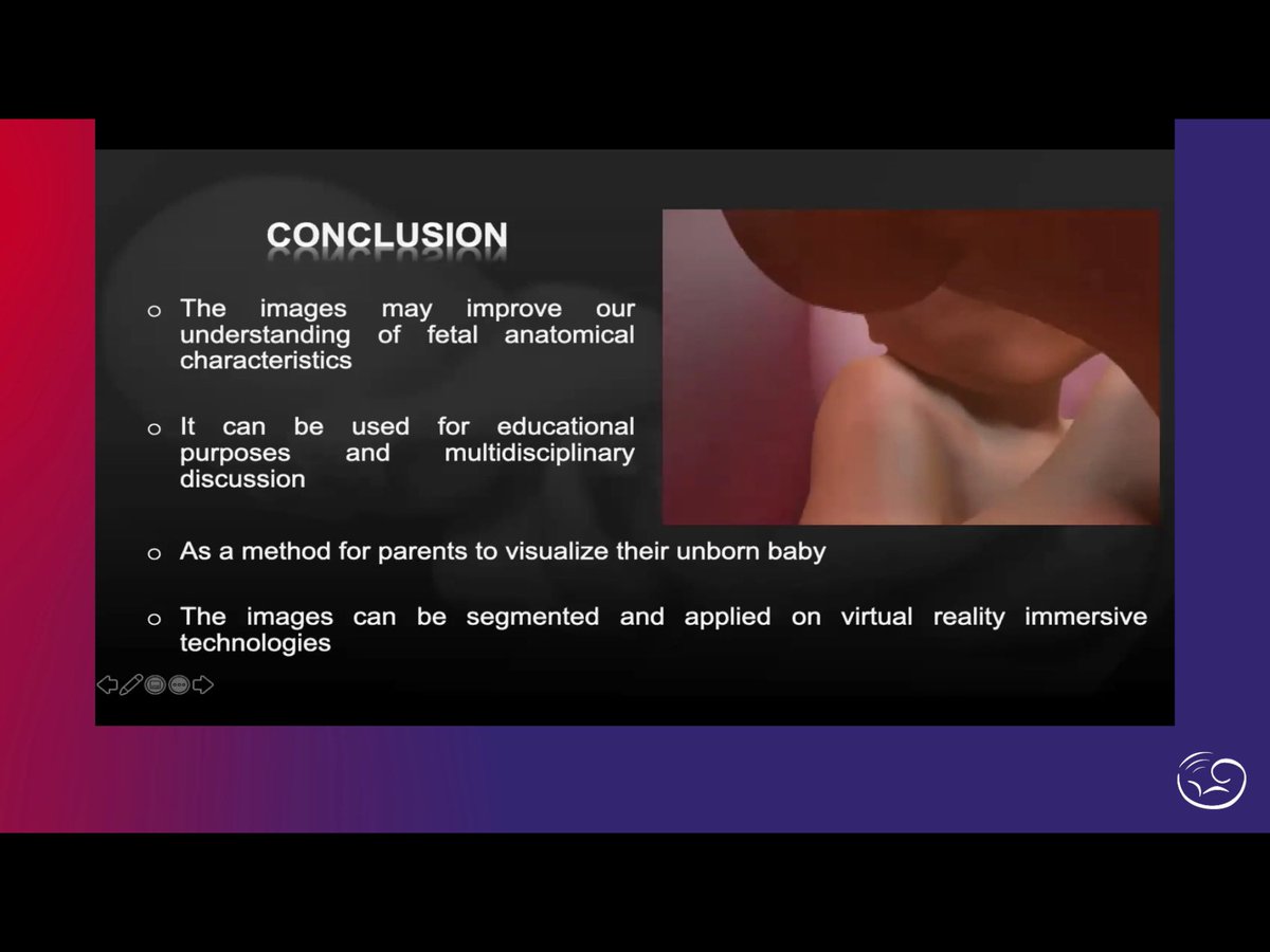 MaternoFetalMX's tweet photo. Amazing images! #VirtualNavigation #ArtificialIntelligence in #Imaging Prof #HeronWerner 
#ISUOG2020 #LoveUltrasound @ISUOG https://t.co/VdJRO1iD5R