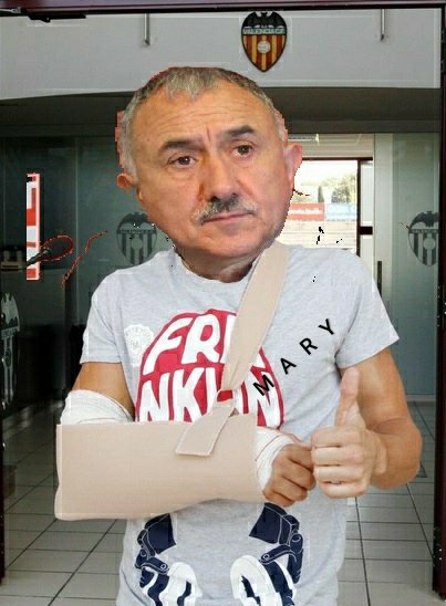 Brooklyn_Tokio's tweet photo. Se ha lesionado por trabajar ayer borrando la pintada 😂😂😂😂 https://t.co/Ah8QKXshIW
