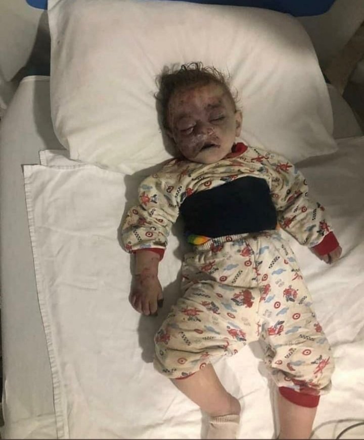 rosse098's tweet photo. @ShStepanyan #QarabagAzerbaycandir tarix boyu bele olub ve olacaq da #StopArmenianTerrorism Xocalıda etdiyiniz soyqırım #Genja'da sivil xalqa qarşı terror. #ChildKillerArmenian
#StopArmenianAggression
#PrayforAzerbaijan
#PrayForGanja
#KarabakhisAzerbajian https://t.co/EnqhewzqxS