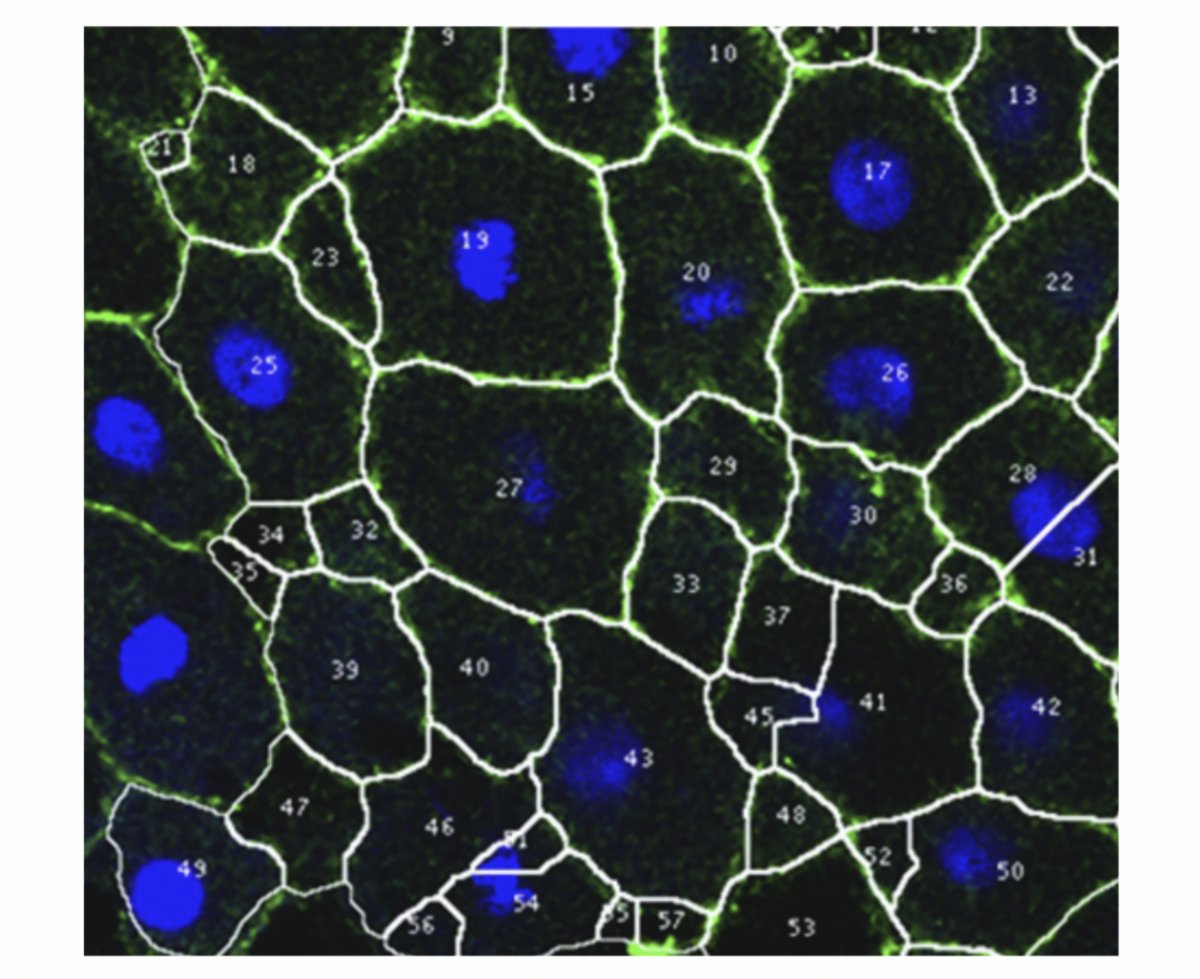Dev_Bio_Journal's tweet photo. #DBfeatures #gastrulation #cellsize
🐟🐟🐟🐟🐟🐟

"Dynamic optima in cell sizes during early development enable normal gastrulation in zebrafish embryos" by Triveni Menon @veni_menon et al. in our Dec 1, 2020 issue.

Find it here -> https://t.co/IJvHKzWyk5 https://t.co/uIDKl5bhJs