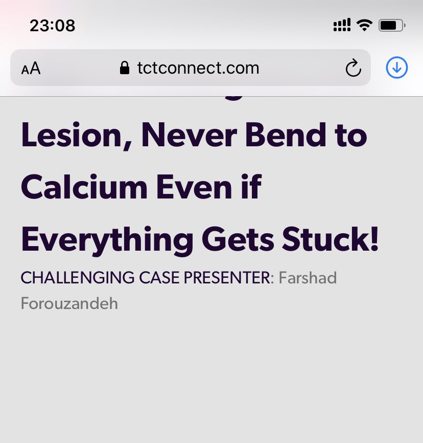 evandrofilhobr's tweet image. Recommended for #ICFIT

This is basic knowledge for performing rotational atherectomy.

He got a stuck burr during roto for a dx LAD lesion. No enough room to park radiopaque wire segment. Burr invaded the radiopaque segment.

Very nice challenging case of Fashad Farouzandeh.